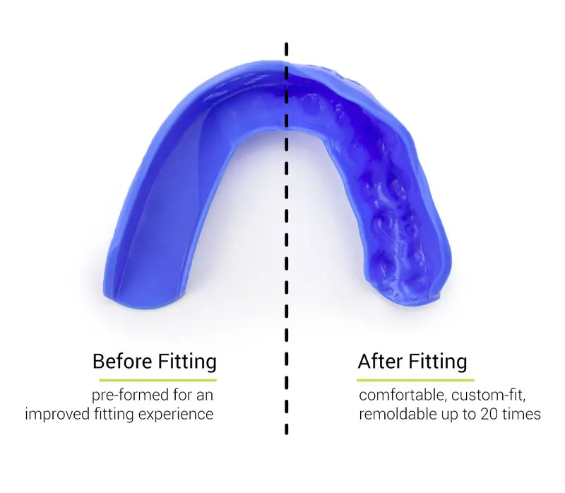 Sisu 3D Custom Fit Mouth Guard 7